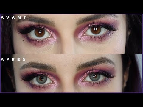 lentilles solotica