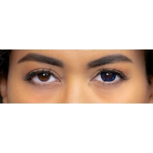 blue colored lenses